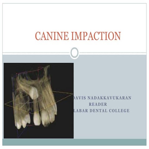 6 canine impaction .pptx