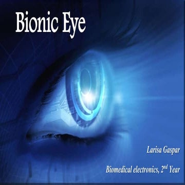 BionicEye