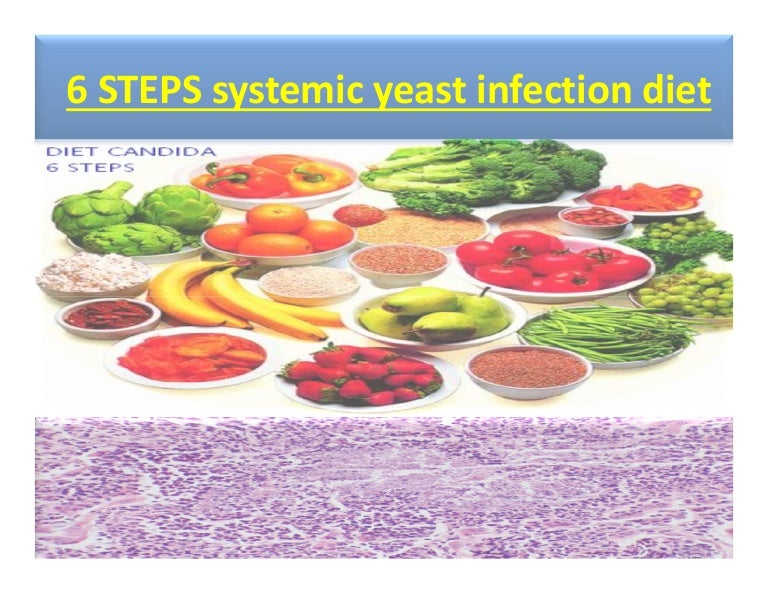 6 steps yeast infection diet