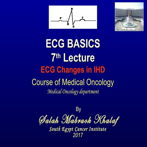 Q WAVE IN ECG,CAUSES OF PATHOLOGICAL Q WAVES | PPTX