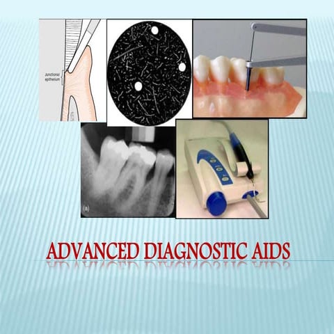 advanced diagnostic aids in periodontics