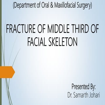 7. fractures of middle third of facial skeleton