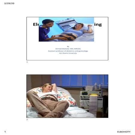 Electronic fetal monitoring