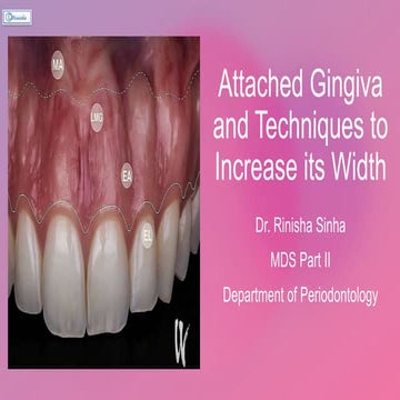 Attached Gingiva.pptx