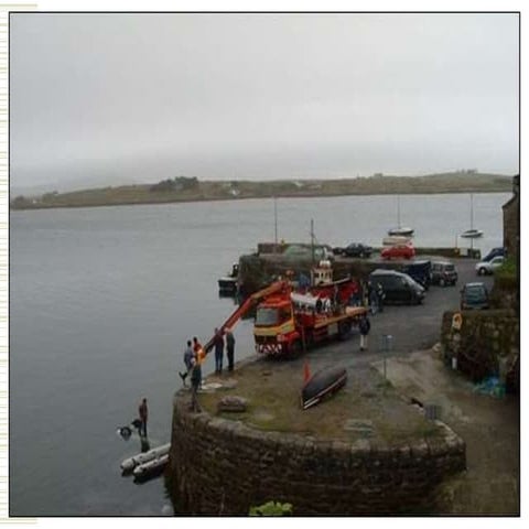 7.2 Bronchiectasis pulmonology for medicine .ppt