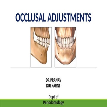 Occlusal evaluation and therapy | PPTX