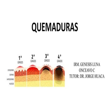 7. LUNA GENESIS. QUEMADURAS..pptxKMKKCKXKM