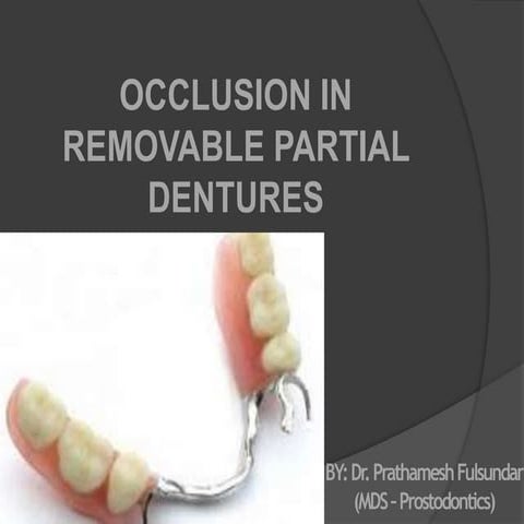 Occlusion in Removable Partial Dentures