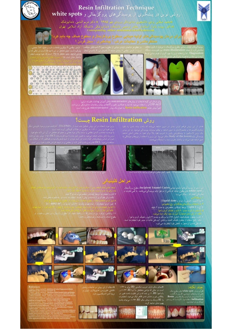 Resin Infiltration Technique