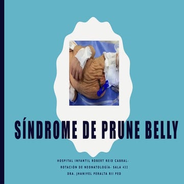 Comprehensive Overview of Prune Belly Syndrome: Diagnosis, Clinical ...