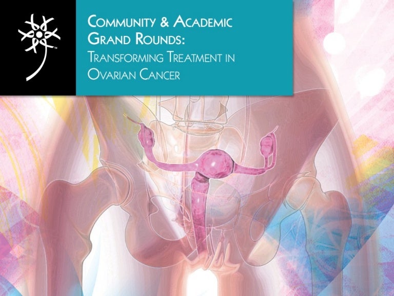 Transforming Treatment in Ovarian Cancer