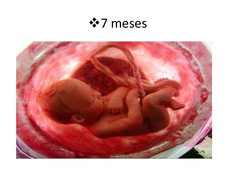 7 Meses