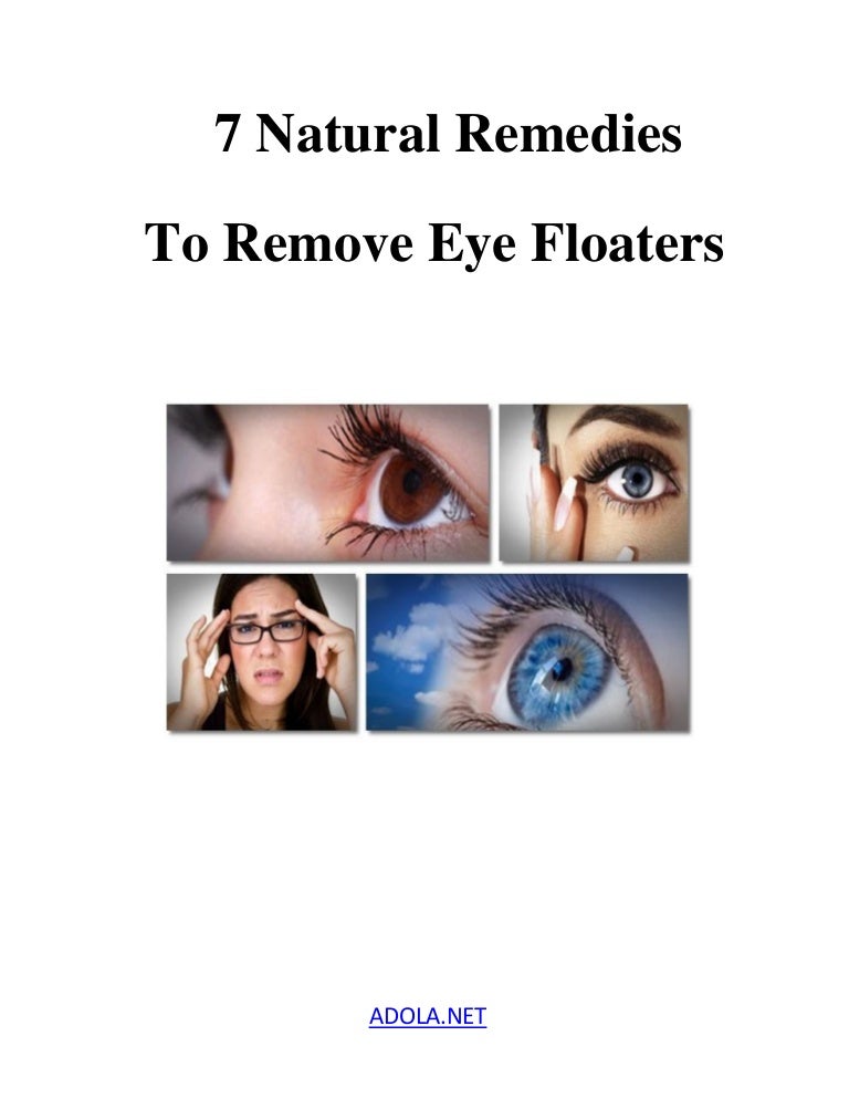7 Natural Remedies To Remove Eye Floaters