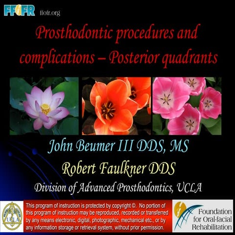  Prosthodontics Procedures and Complications - Posterior Quadrants