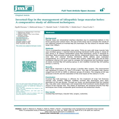 Macular hole surgeries | PDF