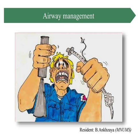 Airway management 