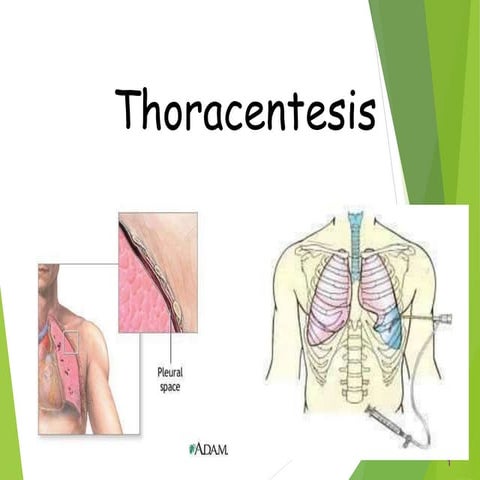 thoracentesis final