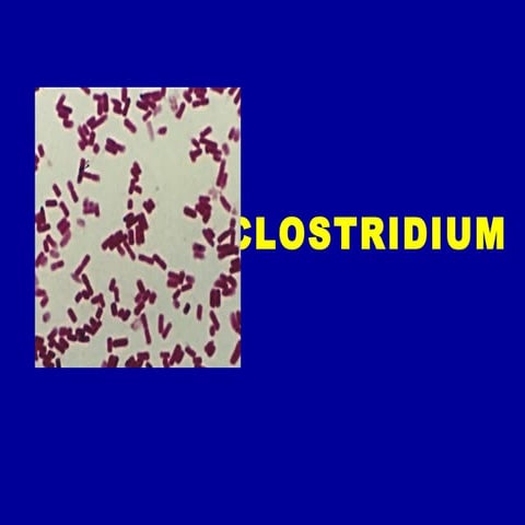 CLOSTRITIUM (clostridia as human pathogens)
