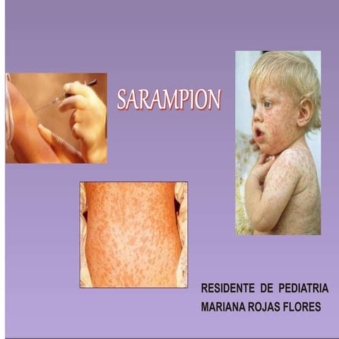 8.- DIAPOS  SARAMPION.pptx