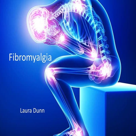 Fibromyalgia powerpoint completed