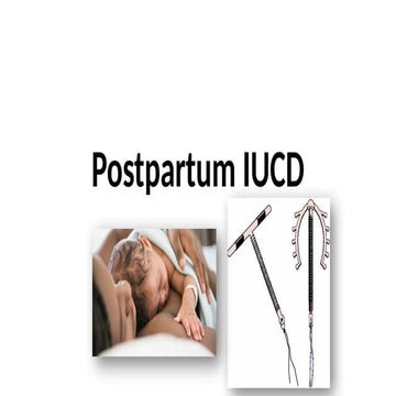 PPIUCD!!!.pptx obstetrics and gynaecology | PPTX