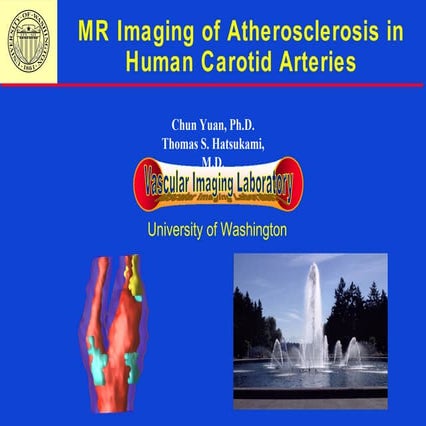 153 mr imaging of atherosclerosis