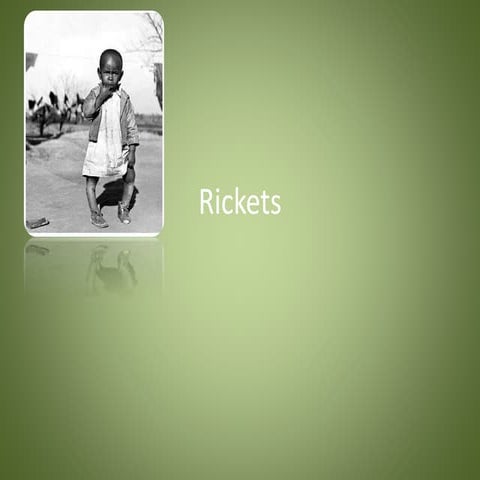 Imaging in rickets | PPTX