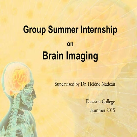 BrainImaging_2015-10-06_22h29