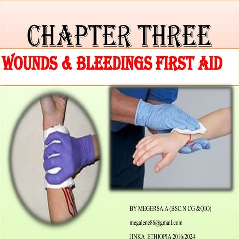 Bleeding management | PPTX