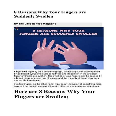 8 Reasons Why Your Fingers are Suddenly Swollen.pdf