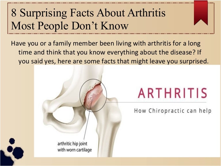 8 surprising facts about arthritis most people don’t know