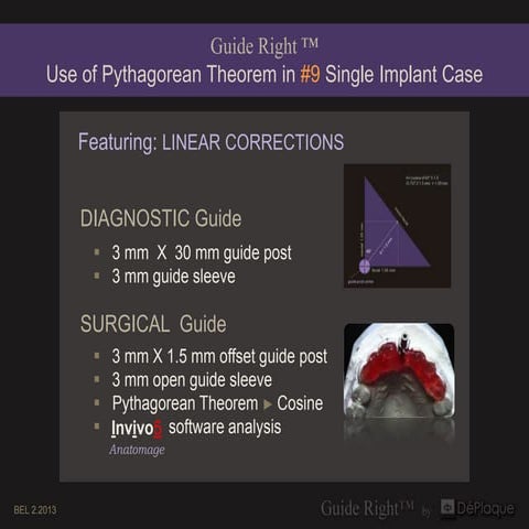 8 use of pythagorean theorem # 9 single implant case