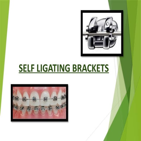 SELF LIGATING BRACKETS IN ORTHODONTICS.pptx
