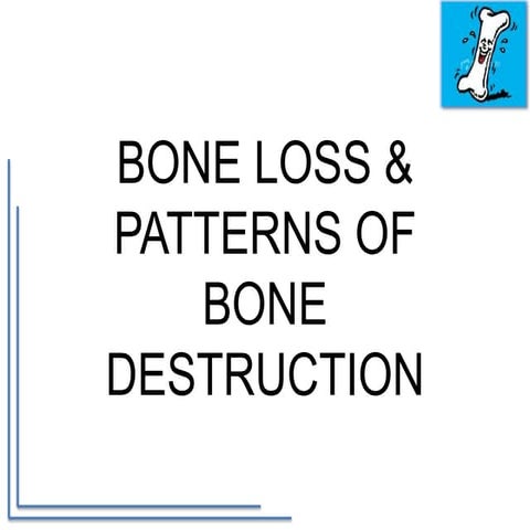    bone loss patterns 
