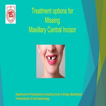 Missing Central Incisor Treatment Options