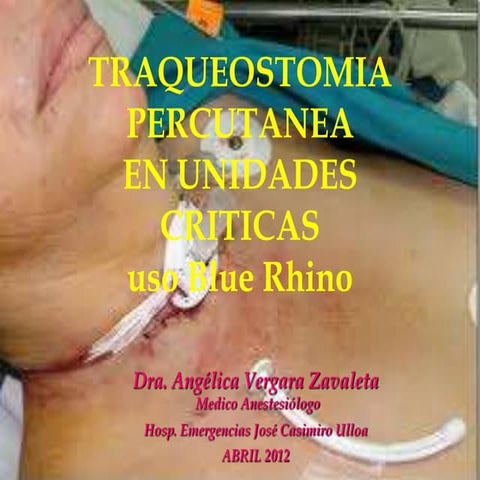 Traqueotomia percutánea en las unidades críticas método rhino - CICAT-SALUD