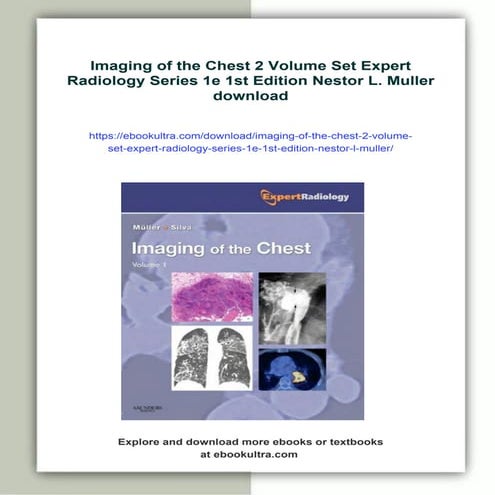 Imaging of the Chest 2 Volume Set Expert Radiology Series 1e 1st ...