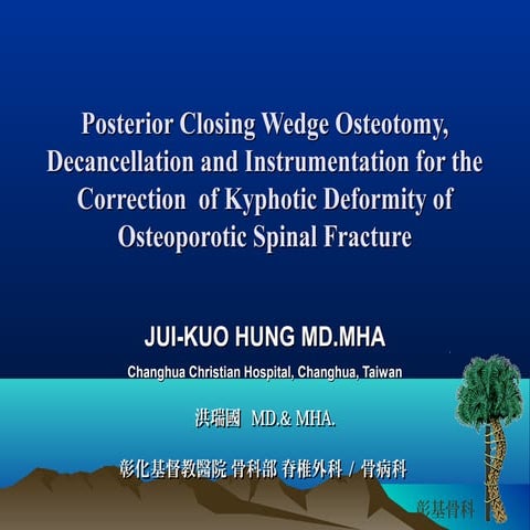 Posterior Closing Wedge Osteotomy, Decancellation and Instrumentation for the...