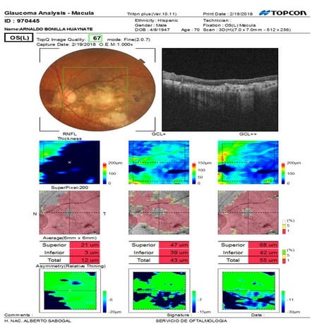 970445 20180219 115233_oct_report_l_001 | PDF