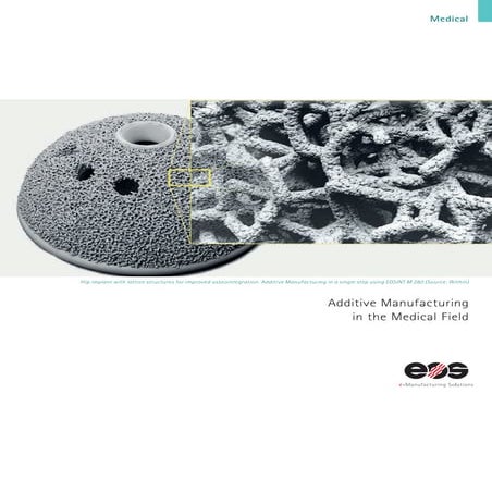 Metal Injection Molding in the Medical Industry | PDF