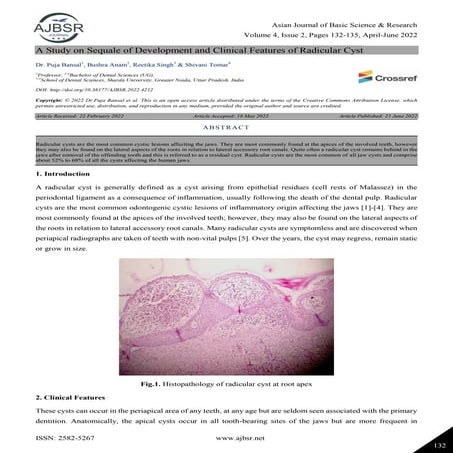 A Study on Sequale of Development and Clinical Features of Radicular Cyst 