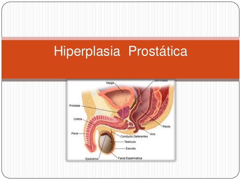 próstata lumbar agrandada