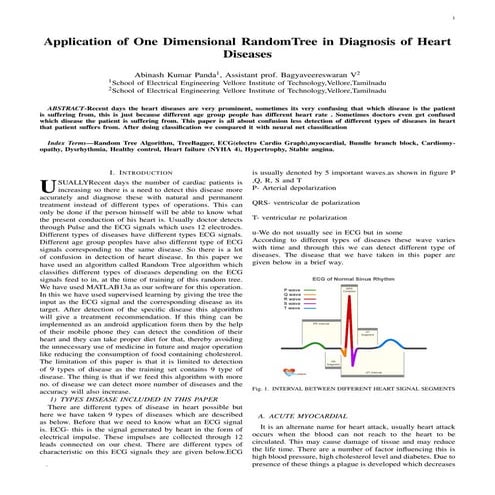 Interpretation of electrocardiography (ECG) by using polynomial ...