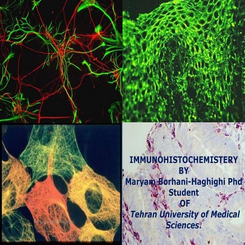 Immunohistochemistery