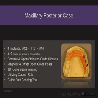 9 maxillary posterior case