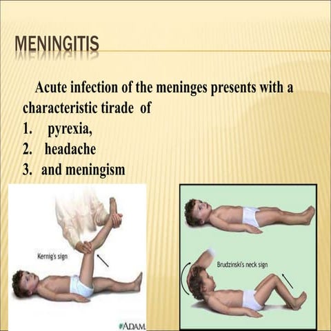 9menengitis.ppt