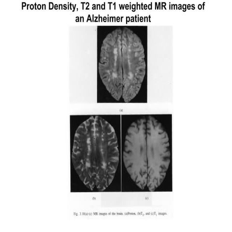 Mri basic sequences | PPTX