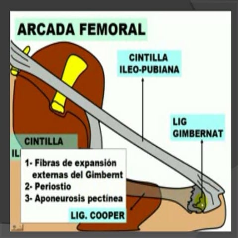 Anatomía del Ligamento Inguinal