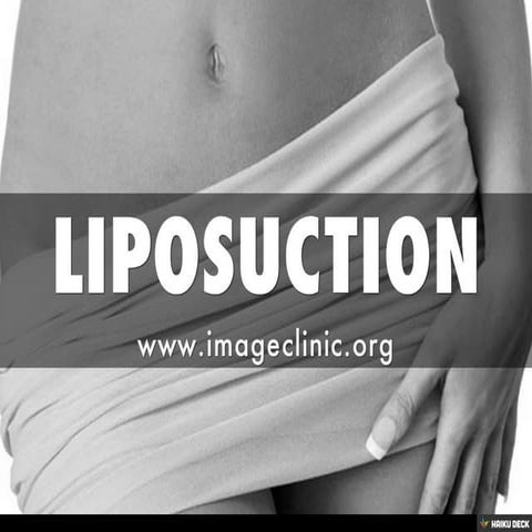 LIPOSUCTION