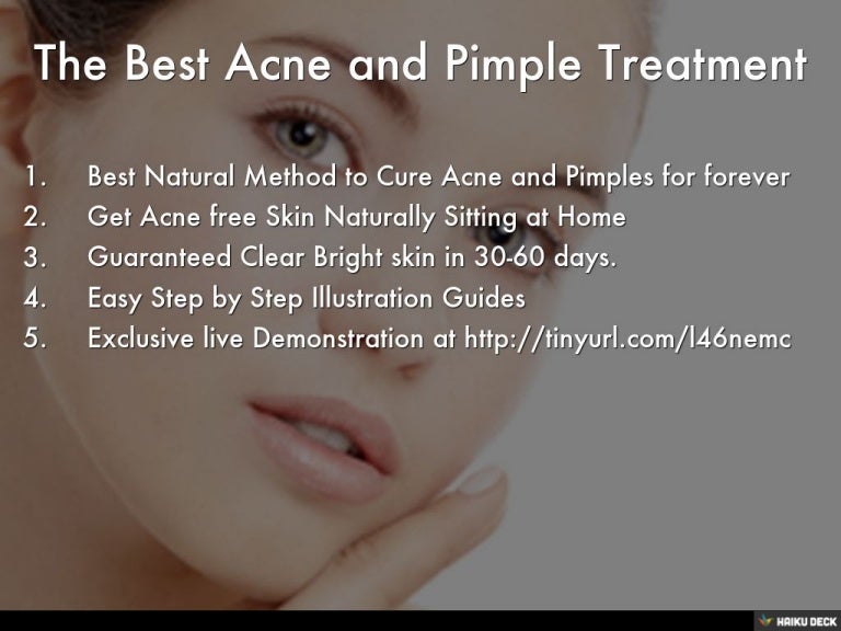 best acne pimple treatment